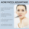 miracle acne patch, beauty secret